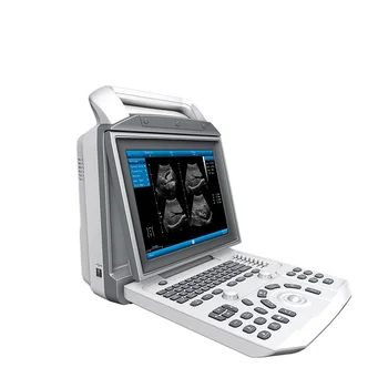  Dizüstü PBWU50 ayarlanabilir açı taşınabilir ultrason 3d tarayıcı makinesi